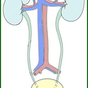 Urinary Bladder Inflammation 