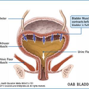 Alternative Treatments For Bladder Inflammation Pictures 