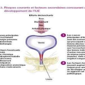 Foul Smelling Urine Causes - Urinary Incontinence In Older Adults