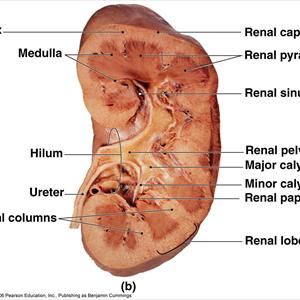  Curing A UTI Without Antibiotics