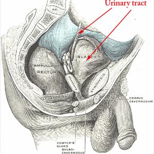 Tests For Chronic Uti How To - Symptoms And Herbal Help For Enlarged Prostate