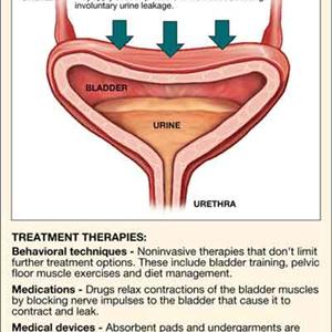 Foul Smelling Urine Support 