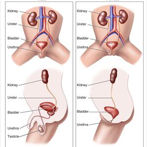 Urinary Tract Infection Uti Beat Naturally - UTI Homeophatic Remedy