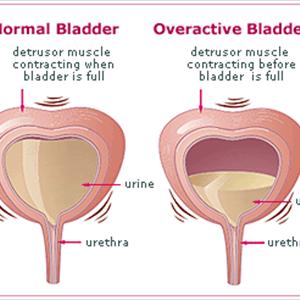 Symptoms Urinary Tract Infection 